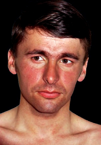 amateur voyeur igor pain bleeding peeing constant female